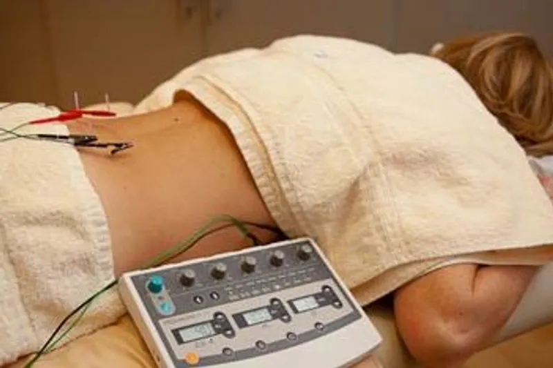 Electro-acupuncture