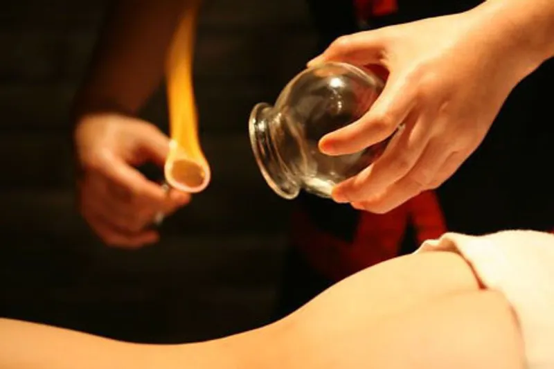 Cupping